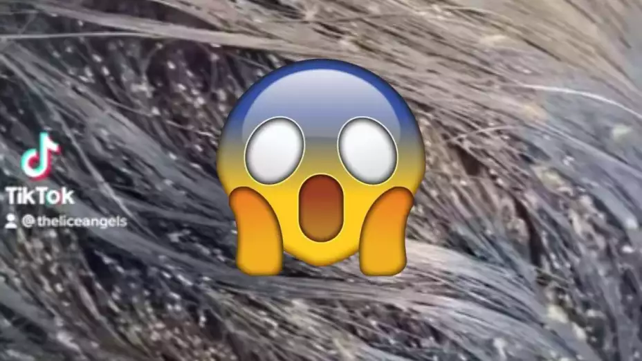 piojos