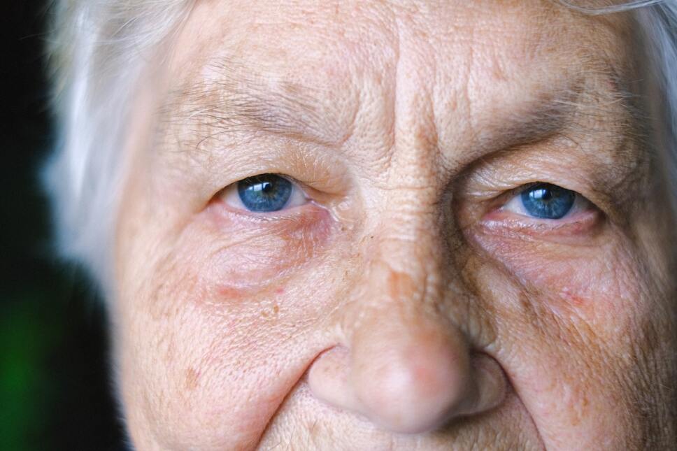 mujer con parkinson