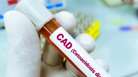 Cetoacidosis diabética