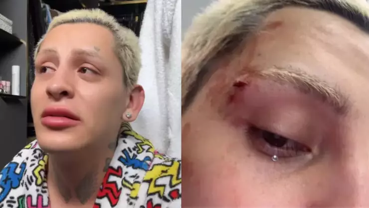 Kunno declara que Pedro Sola lo apoyó tras la agresión que sufrió hace un par de días al salir de un antro