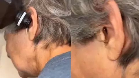 mujer con araña en su oído