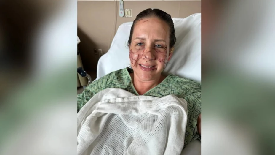 Nutria atacó a Jen Royce arrancando parte de su oreja