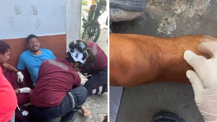 El pasajero resultó lesionado después de caer mientras descendía de un camión urbano