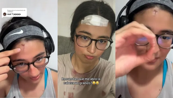 granizo-en-nuevo-león-joven-descalabrada-enorme-granizo-historia-video