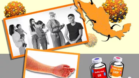 Sarampión en CDMX: la importancia de la vacunación para prevenir contagios