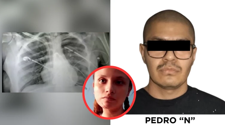 “Todo era para que yo hubiera muerto": Wendy, la enfermera que sobrevivió a 25 puñaladas de su novio, espera justicia