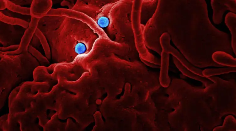 como-contagia-baceteria-klebsiella-oxytoca.jpg