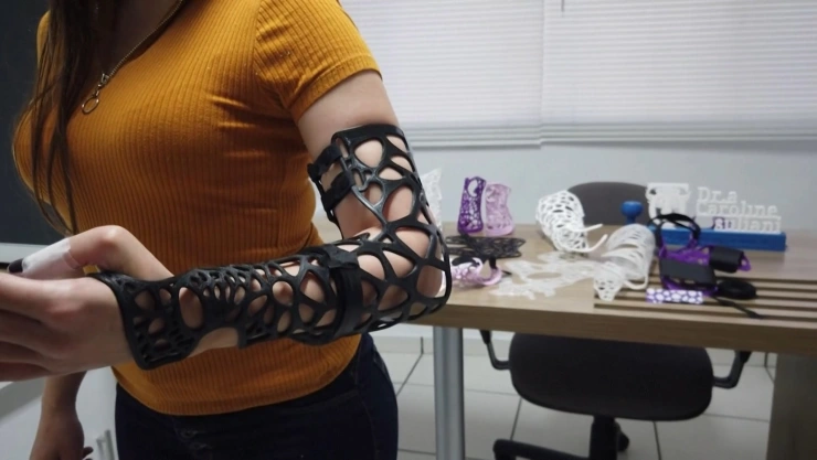 En Brasil jóvenes crearon un molde ecológico que sustituye al yeso.