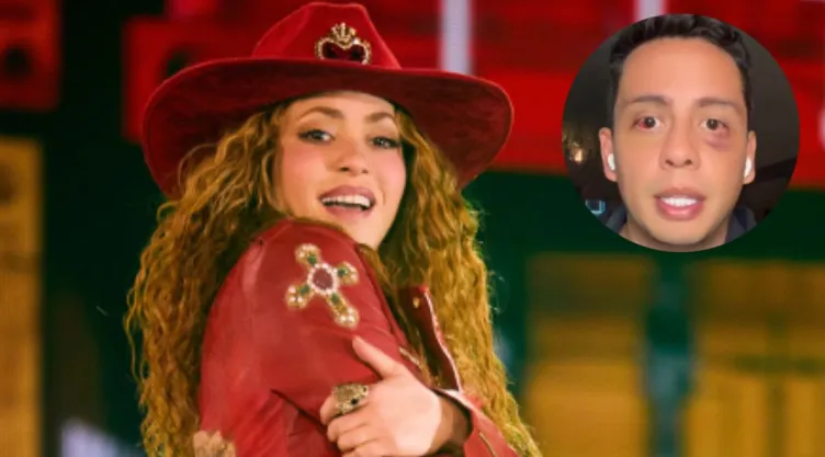 fan-shakira-golpeado-estadio-gnp-seguros-podria-perder-vision-un-ojo.jpg