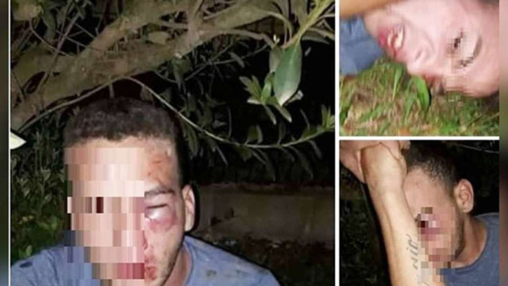 Dan golpiza a hombre tras intentar tener cita con una niña de 12 años