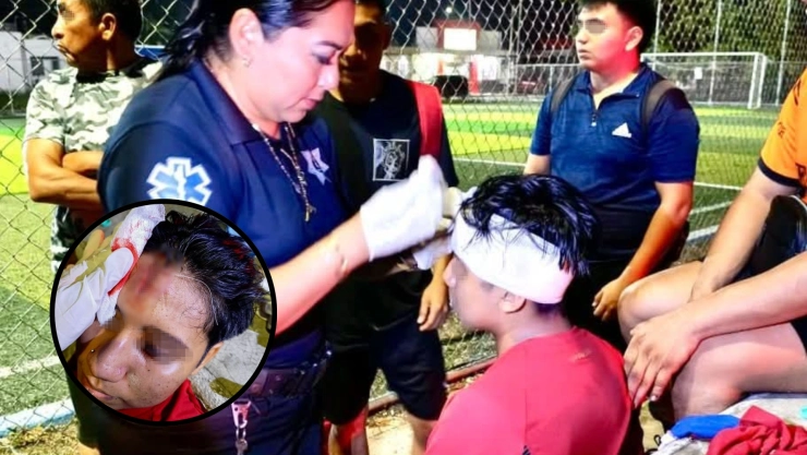 Va a un partido de fútbol en Kanasín y termina con la cabeza ABIERTA; esto le pasó
