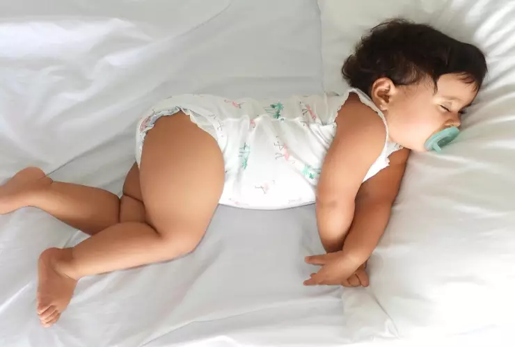 Bebés con “síndrome del hombre lobo” por error en medicamento