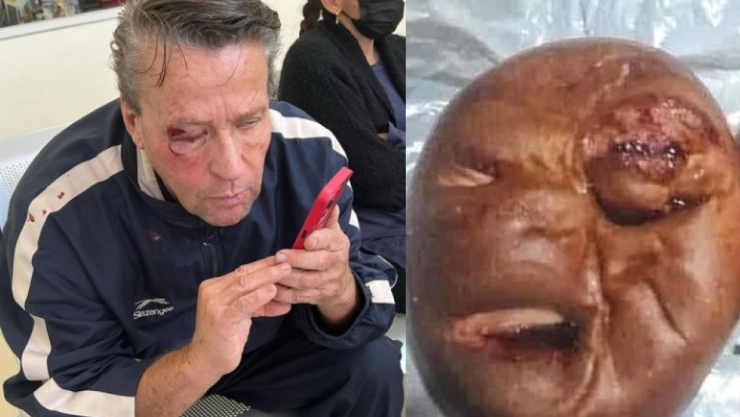 Crean pan del rostro lastimado de Alfredo Adame