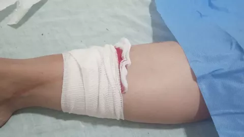 Mujer es agredida con hacha en Choix, Sinaloa