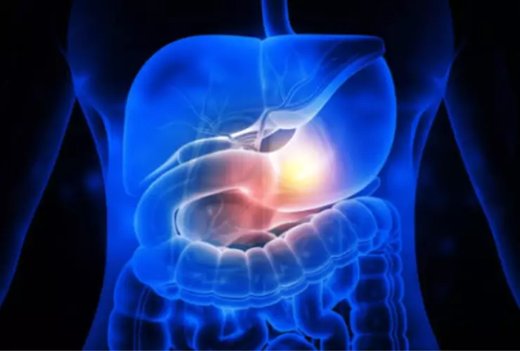 ¡Disfruta de la cena mexicana! Así puedes quitar la acidez estomacal