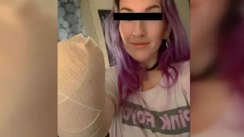 Mujer pierde su mano izquierda tras descarga eléctrica por usar una secadora de cabello