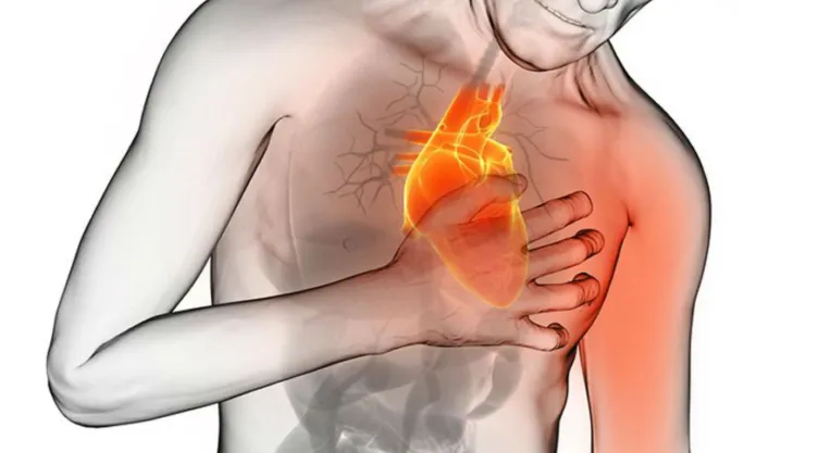Arritmias cardiacas
