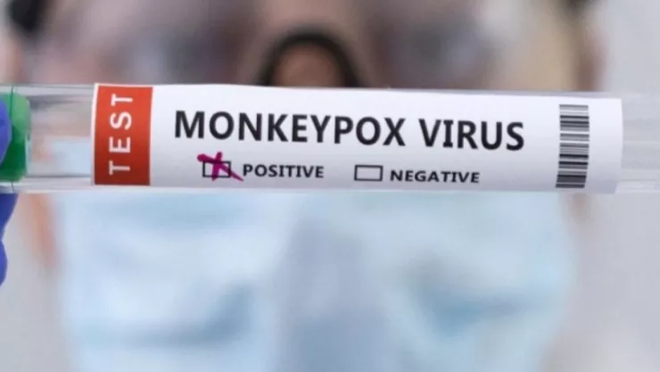 La OMS declara emergencia internacional por viruela del mono hoy 23 de julio del 2022.