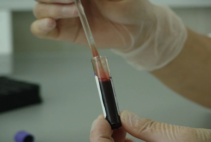 dia mundial del sida