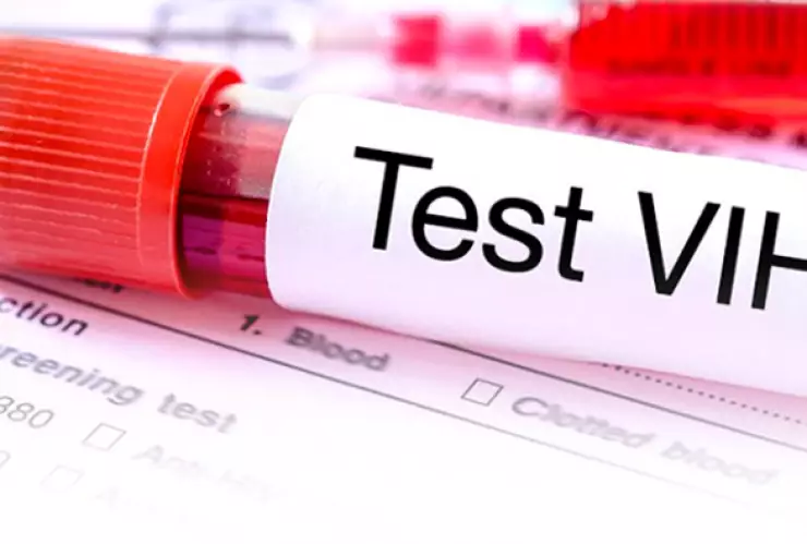 Cada 1 de diciembre se celebra el Día Mundial de la Lucha contra el VIH/SIDA.