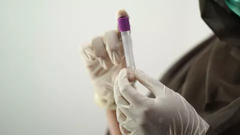 Lista de estados con más casos de VIH en México en agosto 2025; ¿se le considera epidemia