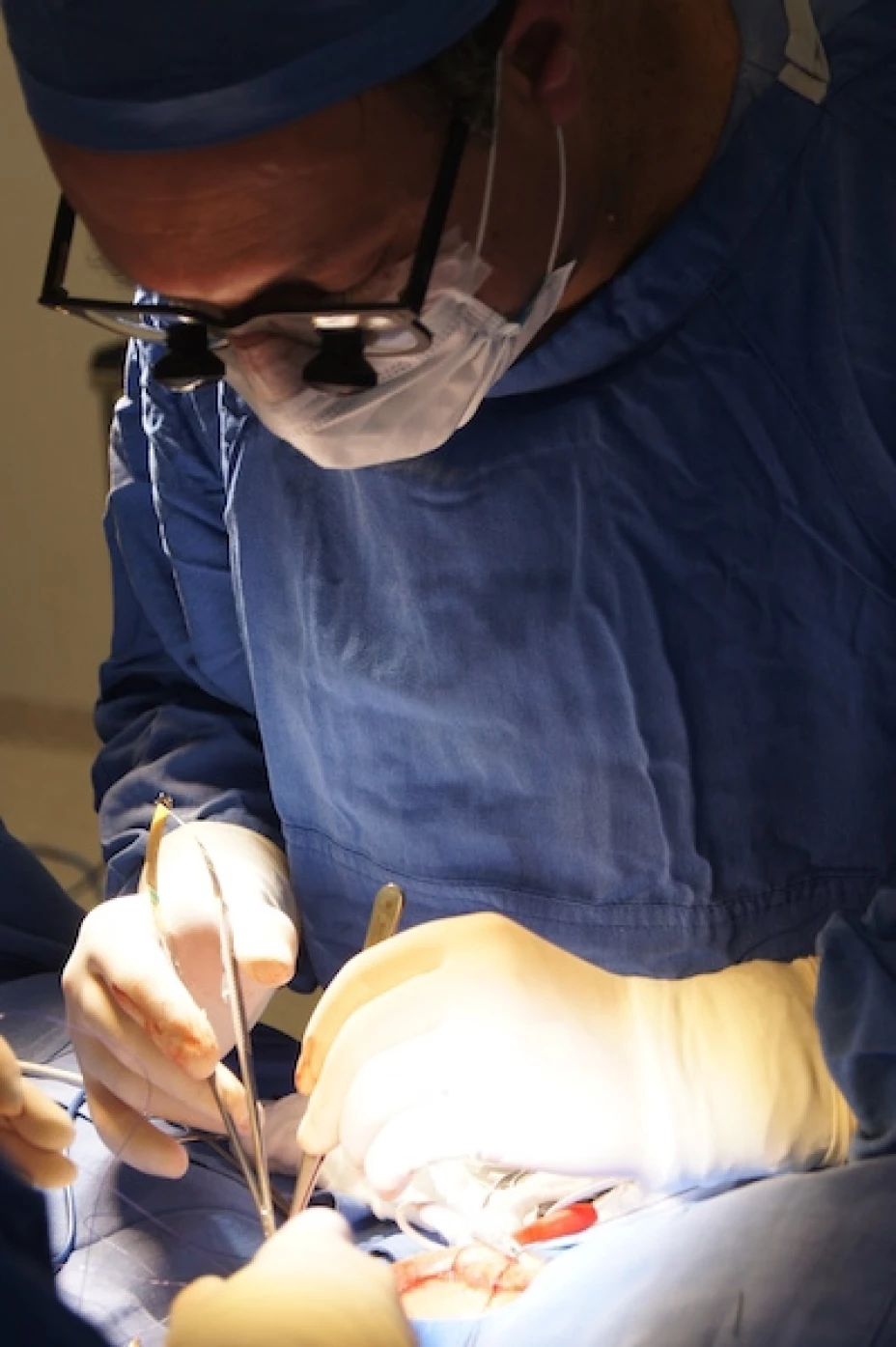 Cirugia cardiovascular