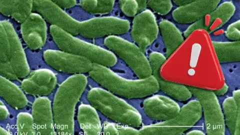 Pánico por bacteria ‘come carne’: Suben las víctimas mortales y esto debes saber