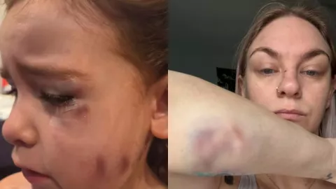 Ataque de perros bulldog deja a dos mujeres y una niña heridas en Canadá