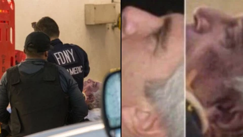 Detectan irregularidades en los rasgos faciales en el cuerpo de Jeffrey Epstein