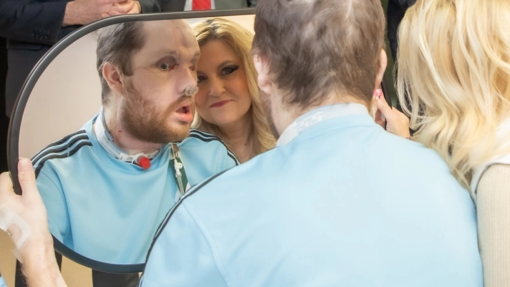 trasplante-rostro-derek-pfaff