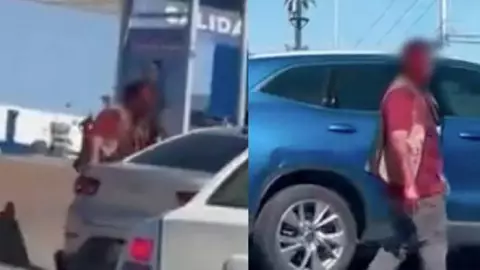 Hombre camina sin la mitad de su cara tras sufrir un grave accidente en Periférico