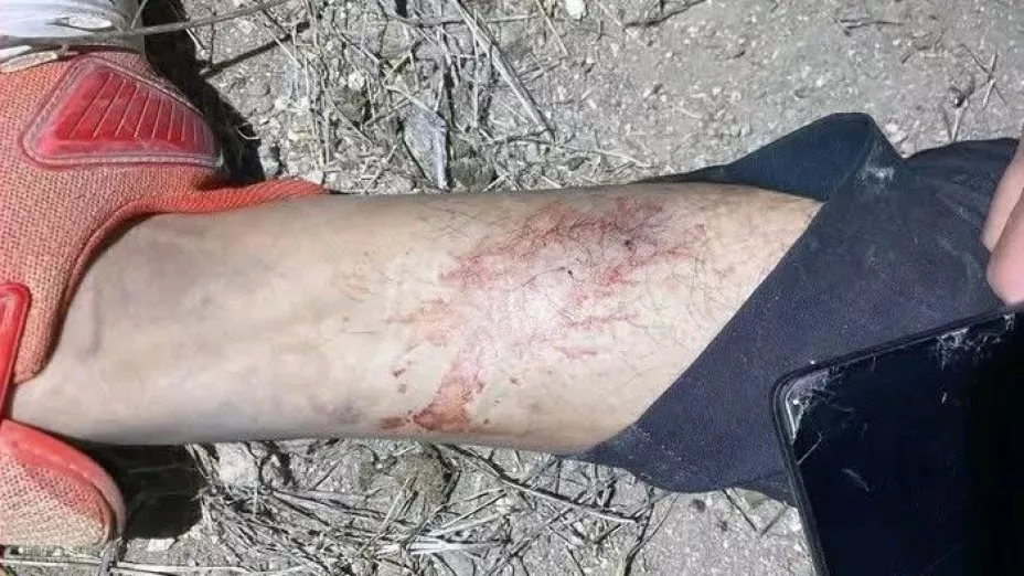 Tragedia en Urbi Villa del Prado: Hombre muere por mordedura de serpiente