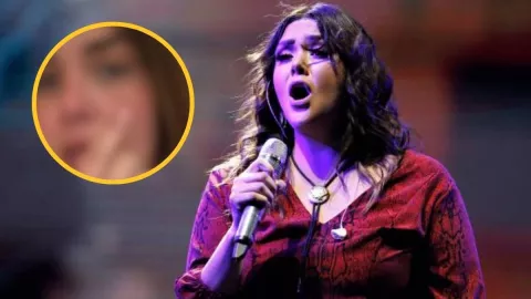 Yuridia revela quemaduras en el rostro