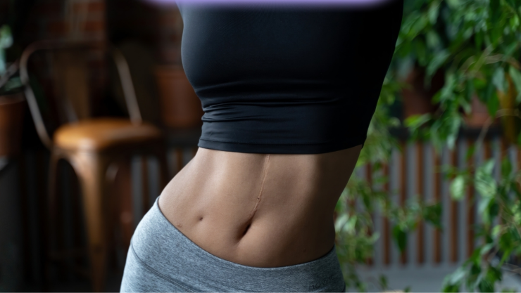 Esto le pasa a tu cuerpo si dejas de consumir azúcar durante dos semanas.
