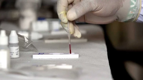 Hepatitis Aguda ¿Qué es y sus síntomas? 