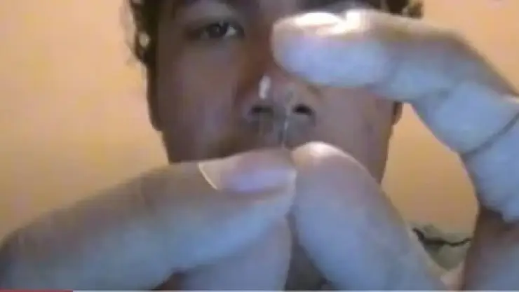 Tutorial rinoplastia.jpg