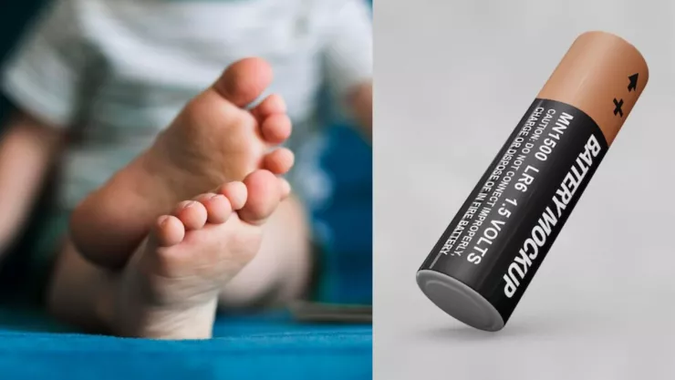 Bebé de dos años se tragó pila.jpg