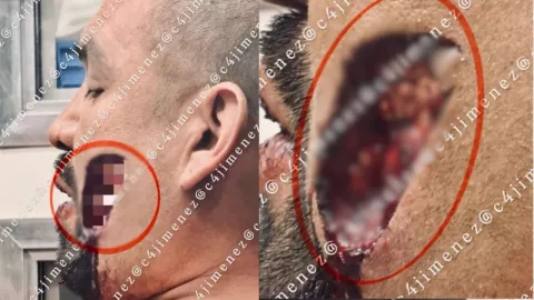 El incidente ocurrió en calles de la colonia Zaragoza, en Venustiano Carranza