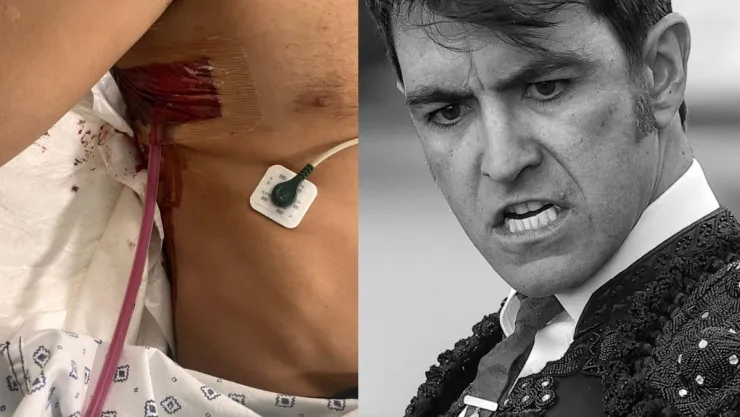 Arturo Macías, el torero sufre cornada, le perforó el pulmón