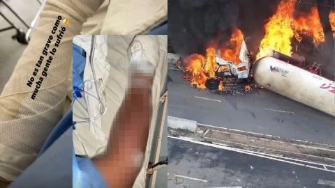 “Reventaba la piel”_ Influencer narra como SOBREVIVIÓ a la explosión de pipa de gas en Iztapalapa.jpg