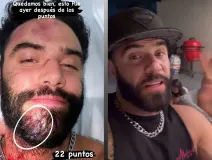 Fernando Lozada revela en La Granja VIP el TERRIBLE asalto que sufrió