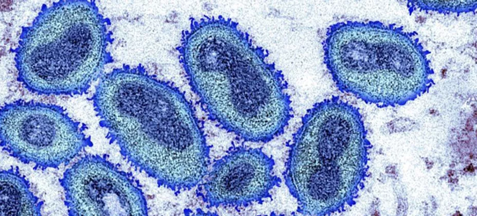 Virus del Mono ONU.jpg