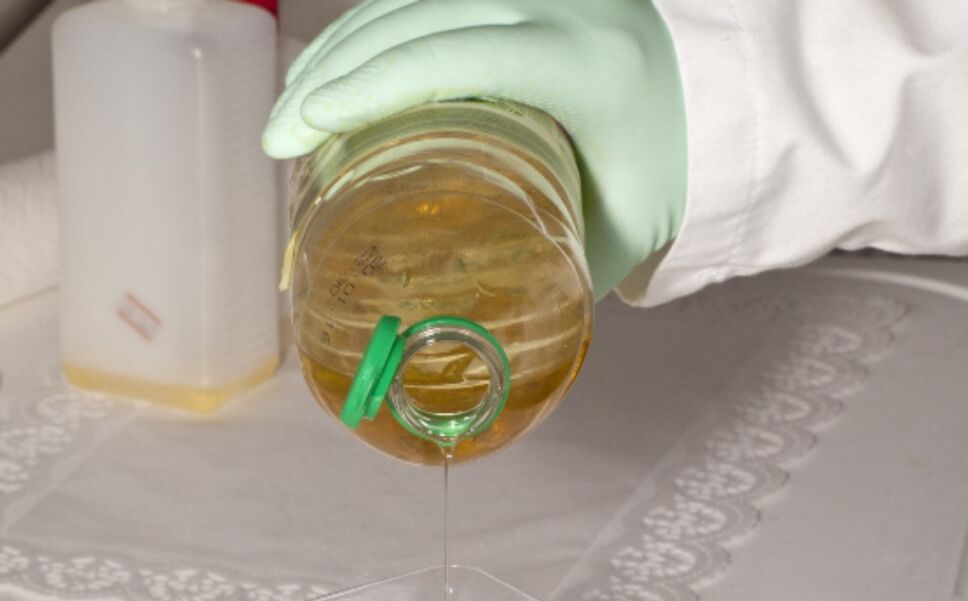 aceite-de-palma-metastasis-cancer