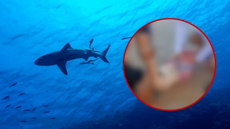 Ataque tiburones Brasil