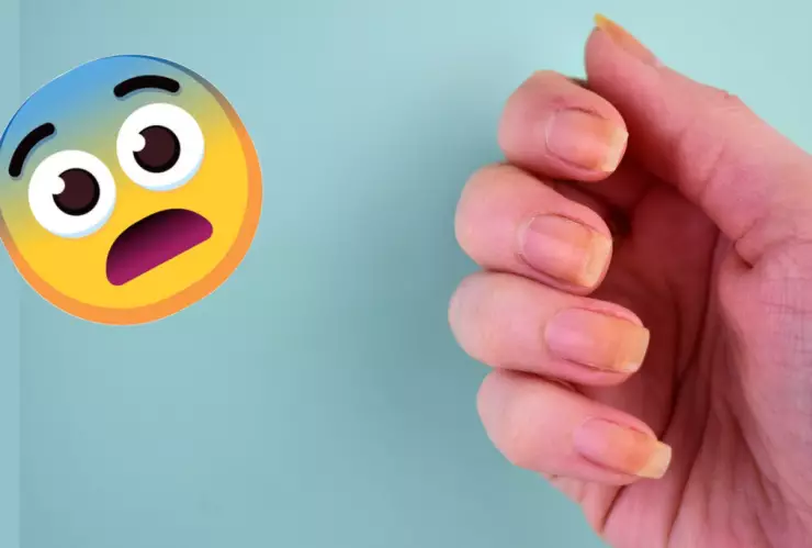 ¿Cómo quitar lo amarillo de las uñas?.jpeg