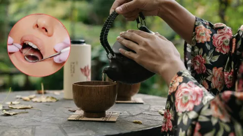 Té verde para el sarro dental: ¿Cuántas veces al día tomar y por qué es recomendable?