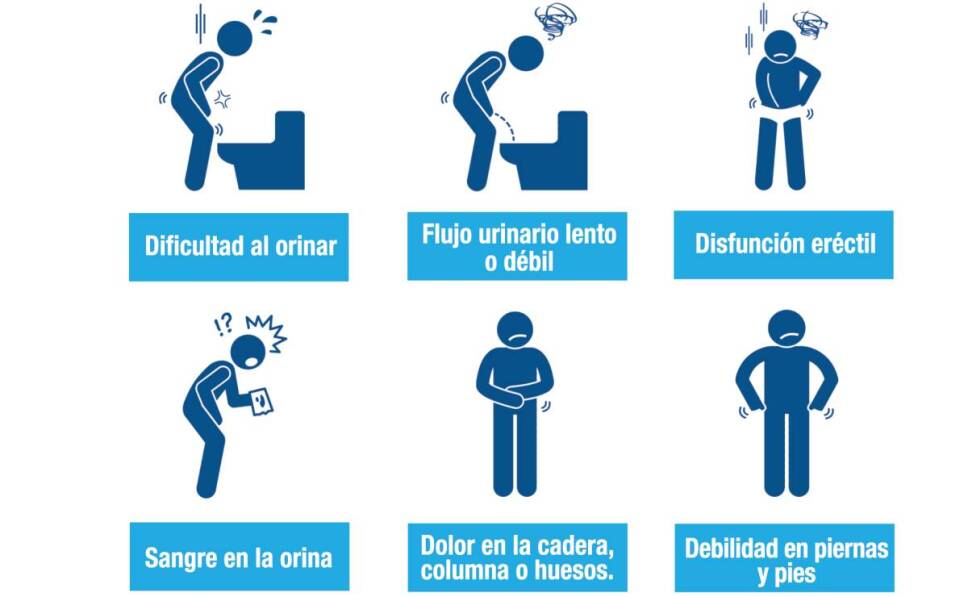 11 de junio Día Mundial del Cáncer de Próstata ¿Cómo prevenirlo (2)