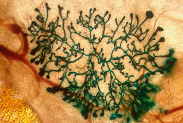 Las células cancerosas hibernan para evadir la quimioterapia