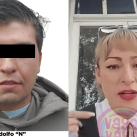 Víctima de Fofo Márquez habla sobre las secuelas permanentes que tiene.png