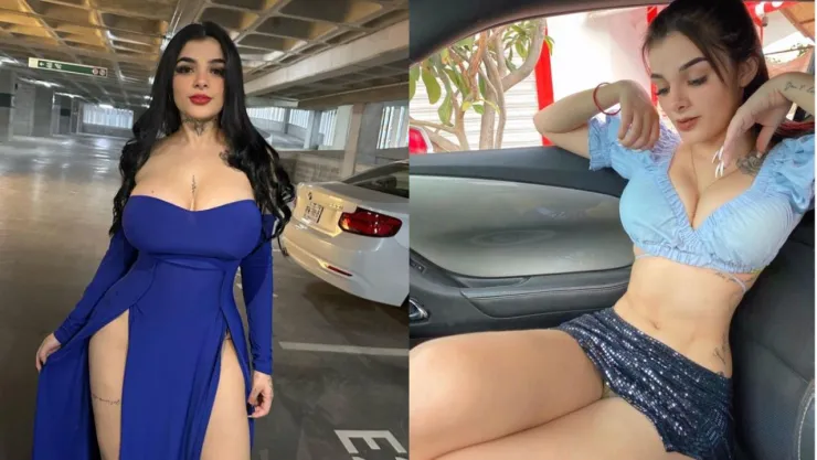 Karely Ruiz antes de las operaciones